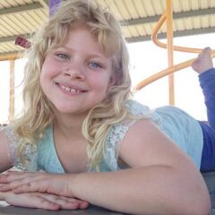 子供の肌荒れとは？原因と対処法をご紹介します！