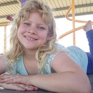 子供の肌荒れとは？原因と対処法をご紹介します！