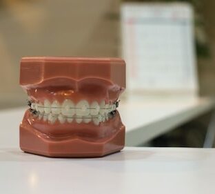 大人の歯列矯正の期間と費用はどれくらい？種類をご紹介します